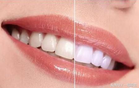 吸烟导致的牙黄能洗干净吗,抽烟牙齿黄怎么清除妙招