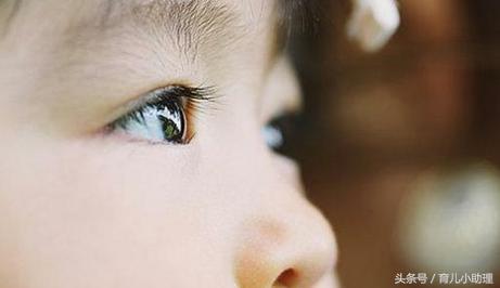 宝宝眼睛有血丝老是搓眼睛,宝宝眼睛泛红有血丝怎么办