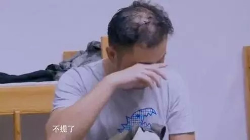 沙溢秃顶电视剧,沙溢秃顶