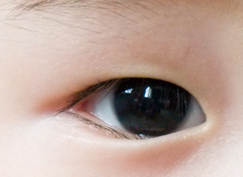 宝宝眼睛老是红血丝怎么回事,宝宝眼睛总是红流泪怎么回事