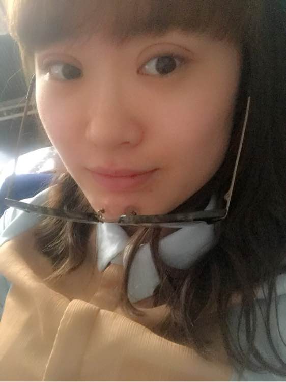 全切双眼皮一个月还是肿怎么回事,全切双眼皮一个月还肿是怎么回事