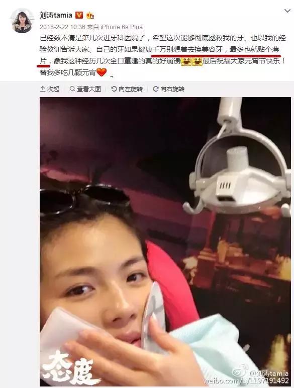 有多少明星整了鼻子,整过的明星有哪些