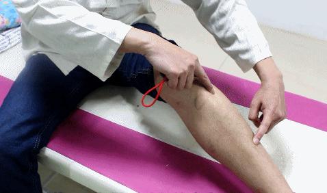 脂肪肝最严重会怎么样,脂肪肝很明显