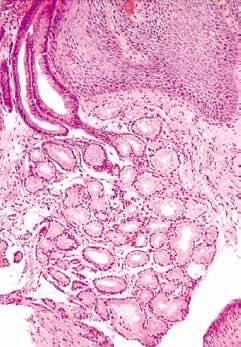 内镜做病理分析大概多久,作为一个医生太感性怎么办