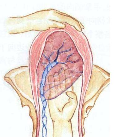 自然分娩三阶段动画,自然分娩第三胎