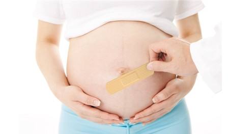 疤痕妊娠凶险度堪比宫外孕剖宫产后2-3年生育第二胎为宜