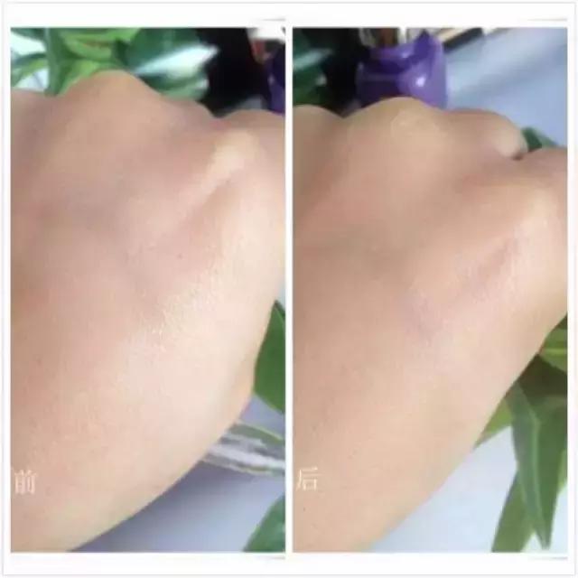 爱美的你一定要知道的小妙招,爱美的你可要多注意啦