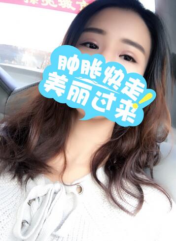 割双眼皮一个月效果,40岁割双眼皮效果好不