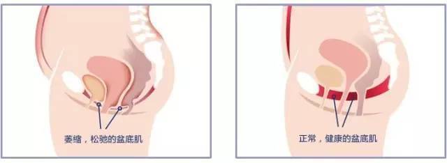 每天坚持两个动作有效瘦腰,怎样快速让腰瘦十厘米