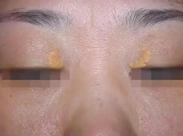 保护心脏需要关注什么,让心脏变年轻的10件事