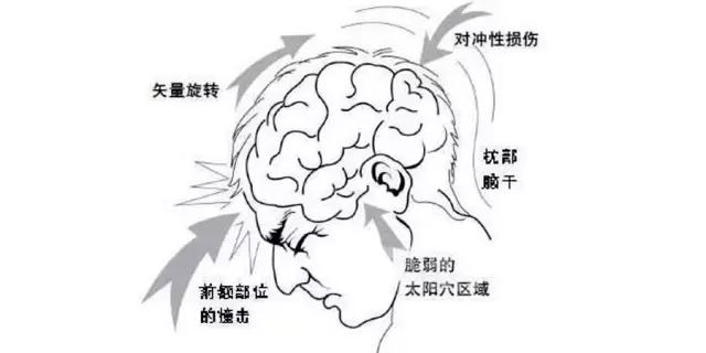 一拳被ko倒地不起会怎么样,被一拳ko的人会有生命危险吗