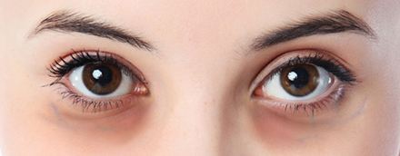 为什么眼周要用专门的眼霜,修正抗皱眼霜提亮眼周淡化黑眼圈