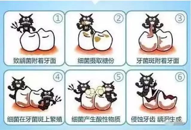 乳牙到底要不要根管治疗,儿童乳牙是全部要换的吗