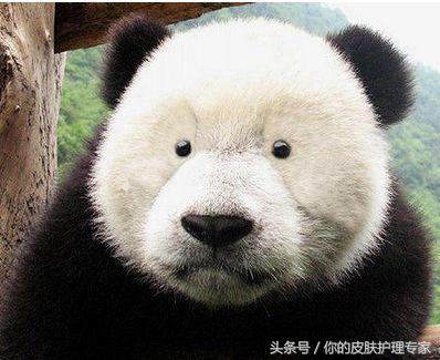 天生黑眼圈怎么办快速去掉,去天生黑眼圈眼袋