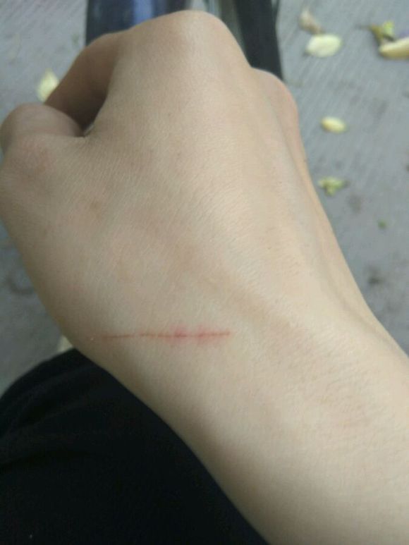 十天前被小狗咬伤了,猫抓伤人后为什么猫死了