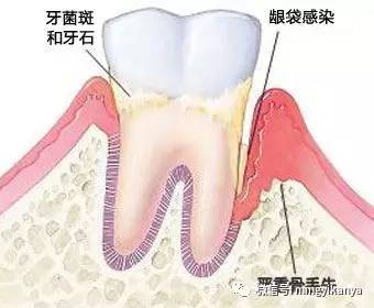 要怀孕前做哪些检查,怀孕了有没有必要去看牙医