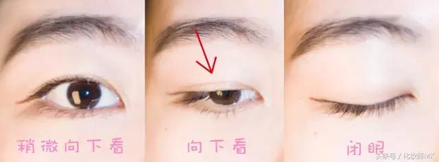 真实贴双眼皮贴,单眼皮怎么贴第二天变双眼皮