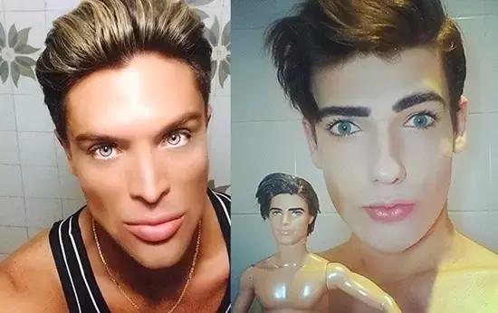 越来越多的男性整形,男士整容变帅案例