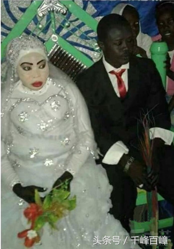 可爱的宝宝斗鸡眼,你们的宝宝斗鸡眼吗