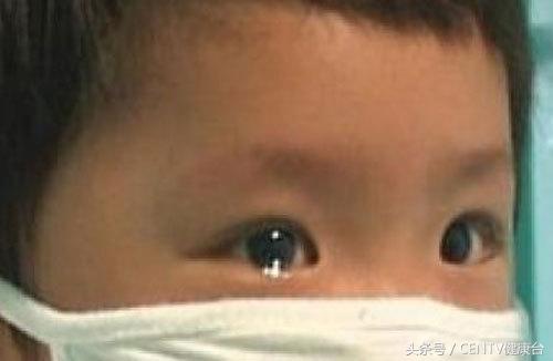 钻胯治病9元一次这样的奇耻大辱真的能治好白血病吗？