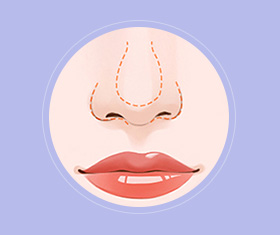 蒜头鼻鼻基底凹陷嘴凸,蒜头鼻和鹰钩鼻图片