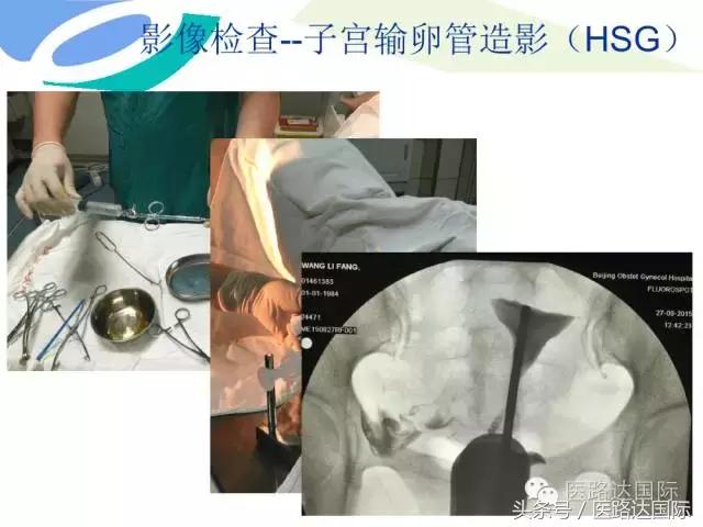 北京妇产医院梁宇霆,北京妇产医院梁宇霆出诊