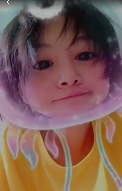 郑爽压力大深夜失眠嘴角上火，头发凌乱还不忘卖萌放飞自我！