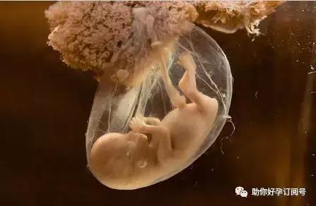 羊水是胎儿生命之水，包含太多孕育信息，你真的了解吗？