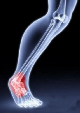 脚踝上下受限恢复训练动作,脚踝强化训练远离脚踝受伤