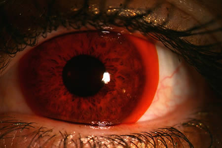 世界上最奇怪的眼睛,世界上最顶级的隐形眼镜