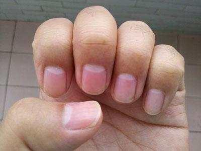 指甲去医院看哪个部位,哪里有看指甲的医院