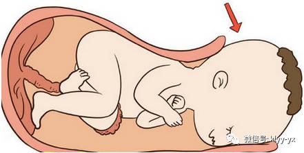 分娩|简直了,有多少孕妇被骗