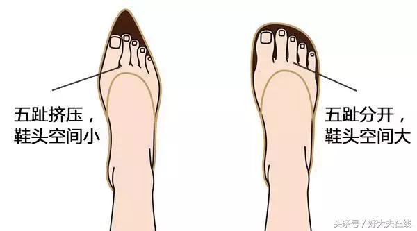 怎么穿鞋不会太脏,脚穿鞋出汗怎么办