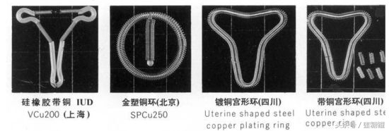 上环（宫内节育器）会导致感染和流产吗？