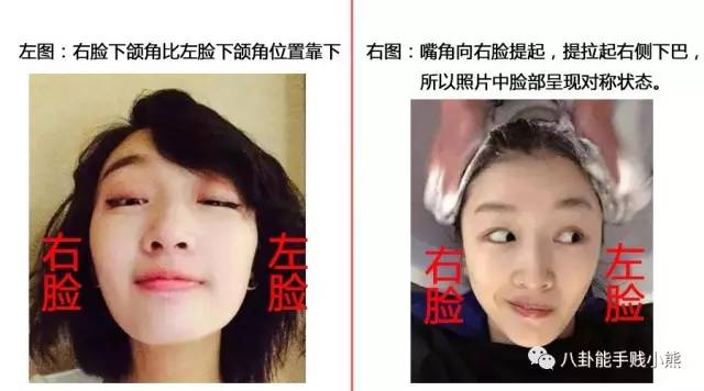 周冬雨鹿晗黄子韬的同款不对称下颌角，值得拥有吗？