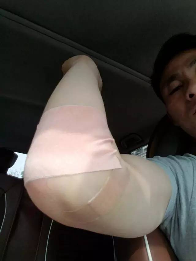 腱鞘炎需要停止打球吗,腱鞘炎问答