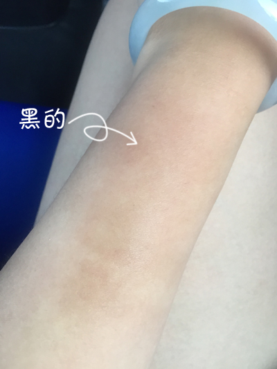 去海边晒伤了怎么办怎么修复,海边游玩晒伤之后怎么处理