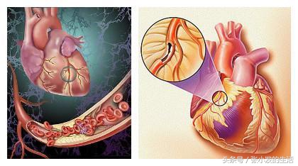 常用心血管系统药物清单,心血管内二科常用药物分析