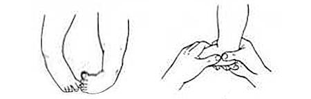 脑瘫康复训练-足下垂该怎么训练？