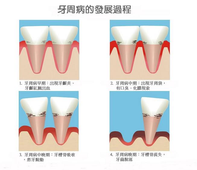 口腔里的细菌能杀菌吗,不刷牙口腔里的细菌