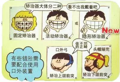 牙齿矫正的基本流程,牙齿矫正基本流程