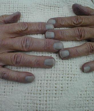 一般来说健康的指甲是什么样子,健康指甲的正常颜色
