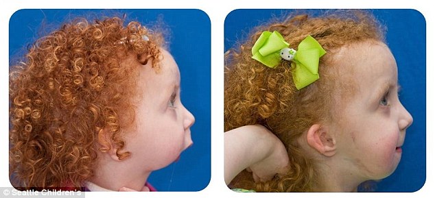 没有下巴的女孩长什么样子,一出生就没有胳膊的女孩