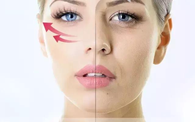 抢救假性眼纹、眼袋的黄金时间，错过你就老了