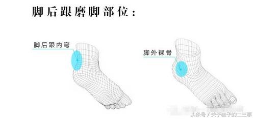 新鞋磨脚是鞋的问题还是脚的问题,新鞋磨脚怎么办可以用醋浸泡吗