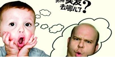 济南遗传性脱发植发效果如何,脂溢性脱发遗传性脱发植发有用吗