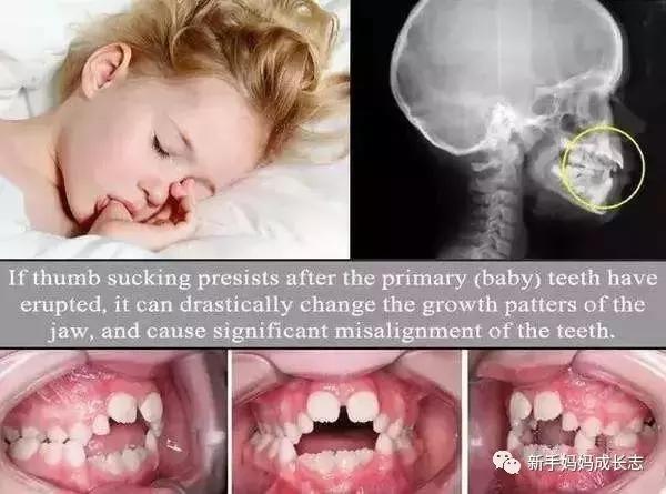 哄睡儿童睡觉的方法,睡眠强效催眠曲30分钟哄睡