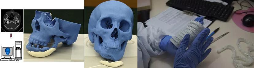 人工卵巢3d打印方法,人体器官能3d打印吗