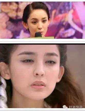 杨紫问怎么去除天生的法令纹!刘诗诗、娜扎也想知道答案啊!