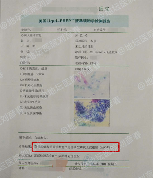 宫颈cin1级怎么做物理治疗,宫颈cin1级激光术后遗症